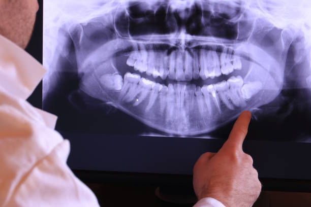 Best Emergency Treatment for Oral Infections in Camp Wood, TX