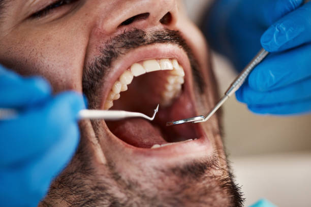 Best Emergency Dental Care for Sports Injuries in Camp Wood, TX